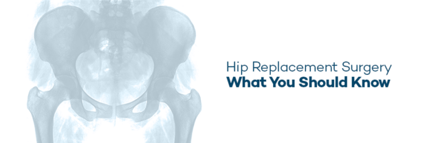 Hip Replacement Surgery What You Should Know
