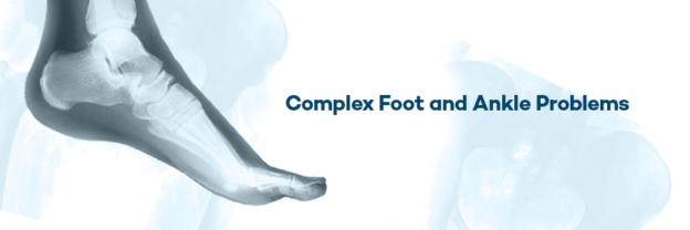 complex Foot and ankle Problems