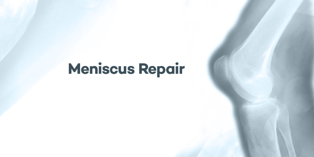 Meniscus Repair