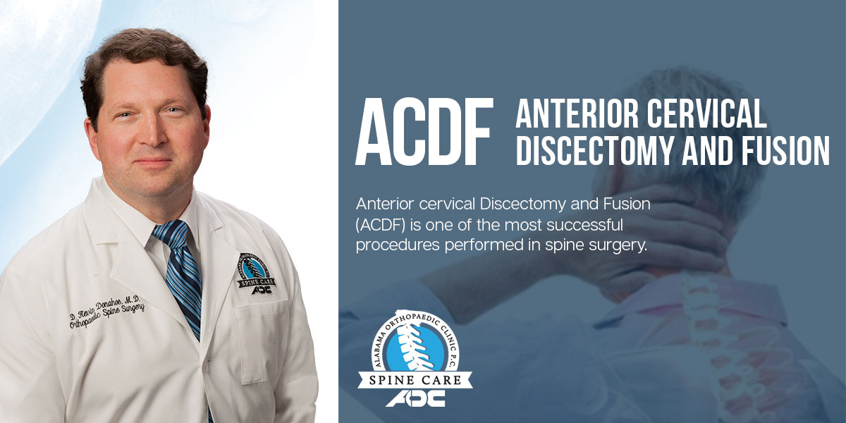 Dr. Donahoe explains Anterior cervical Discectomy and Fusion (ACDF) is one of the most successful procedures performed in spine surgery.