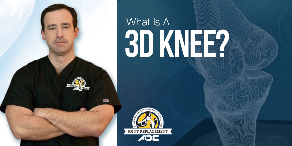 Dr. Barber answers the question - What Is A Custom Knee Replacement 3D Knee?